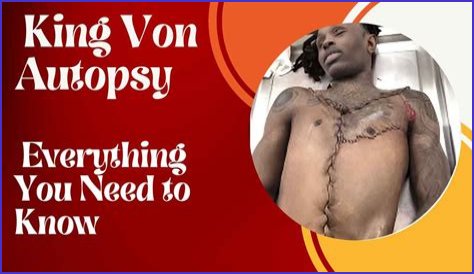 King Von Autopsy Photo: An Insight Into The Life And Legacy Of A Rising Star